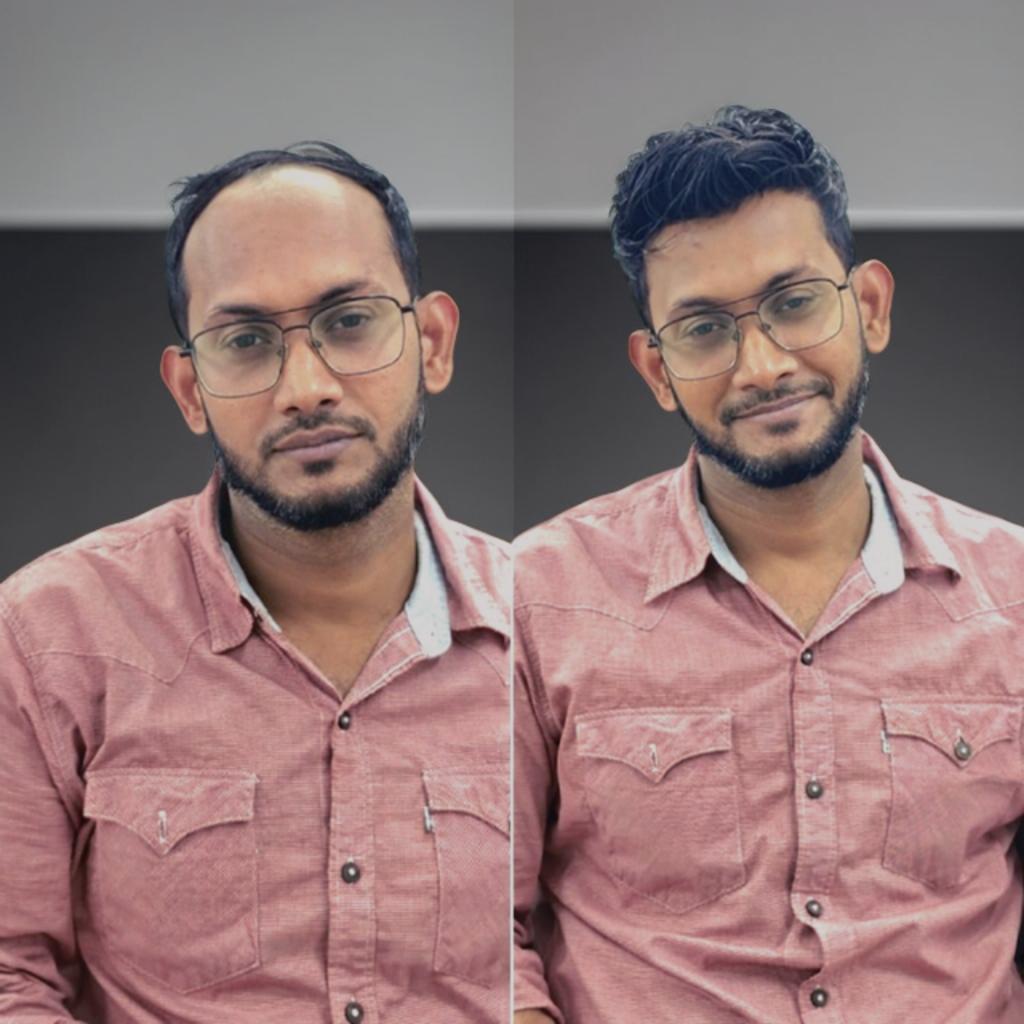 Before and after hair restoration result at Cosmetica Hair Studio